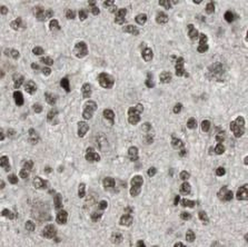 CSNK2A1 Rabbit Polyclonal Antibody