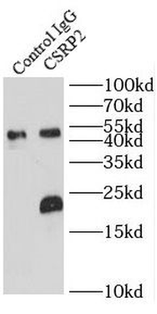 CSRP2 Antibody