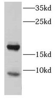 CST8 Rabbit Polyclonal Antibody