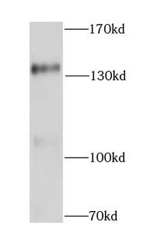 CTCF Rabbit Polyclonal Antibody