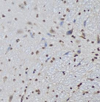 CTCF Rabbit Polyclonal Antibody
