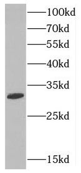 CTDSP2 Antibody