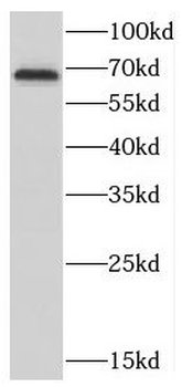 CTDSPL2 Rabbit Polyclonal Antibody