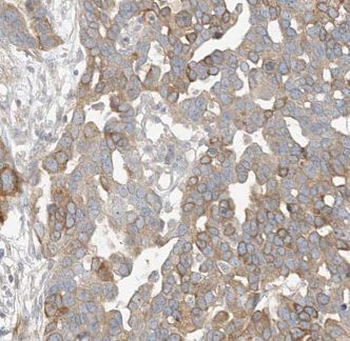 CTDSPL2 Rabbit Polyclonal Antibody