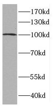 CTNNA3 Rabbit Polyclonal Antibody