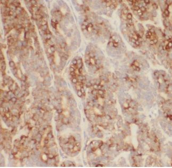 CTNNA3 Rabbit Polyclonal Antibody