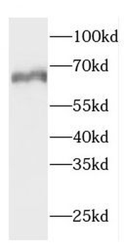 CTPS1 Rabbit Polyclonal Antibody