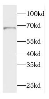 CTPS2 Rabbit Polyclonal Antibody