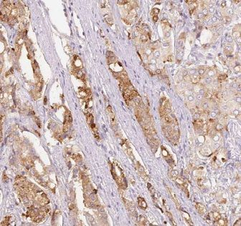 CTPS2 Rabbit Polyclonal Antibody