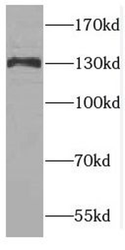 CTR9 Rabbit Polyclonal Antibody