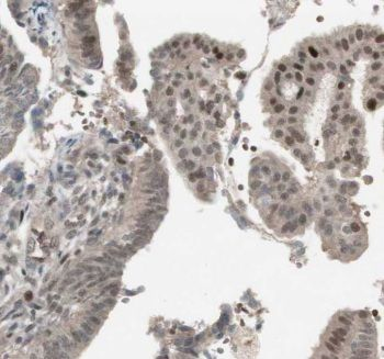 CTR9 Rabbit Polyclonal Antibody