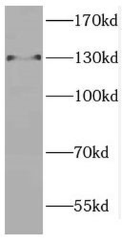 CTR9 Rabbit Polyclonal Antibody