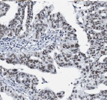 CTR9 Rabbit Polyclonal Antibody