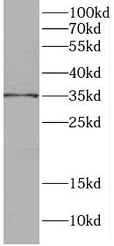 C1QTNF1 Rabbit Polyclonal Antibody