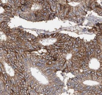 C1QTNF1 Rabbit Polyclonal Antibody