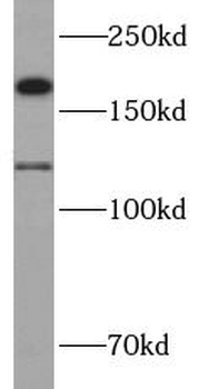 CTTNBP2 Antibody
