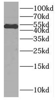 CELF2 Rabbit Polyclonal Antibody