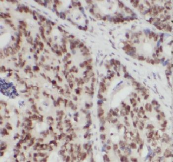CELF2 Rabbit Polyclonal Antibody