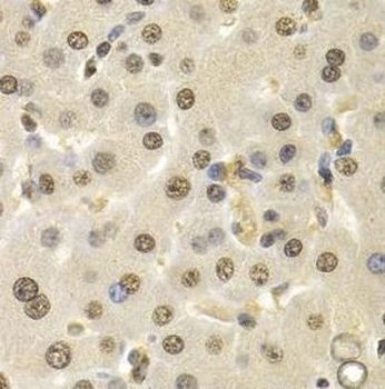 CUL4B Rabbit Polyclonal Antibody