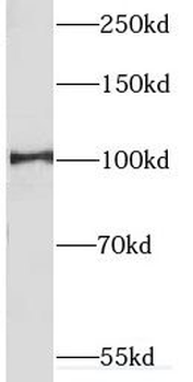 CUL4B Rabbit Polyclonal Antibody