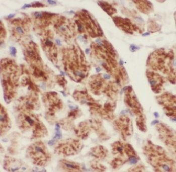 CUL7 Antibody