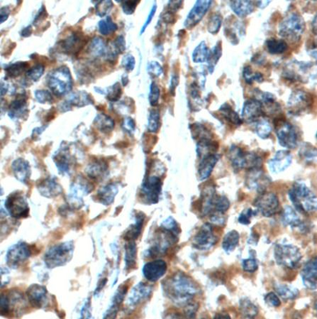 CXCL13 Rabbit Polyclonal Antibody