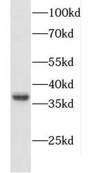 CXXC5 Rabbit Polyclonal Antibody