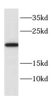 CYB5B Antibody