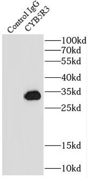 CYB5R3 Antibody