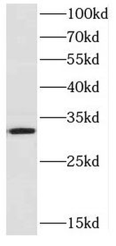 CYB5R3 Antibody