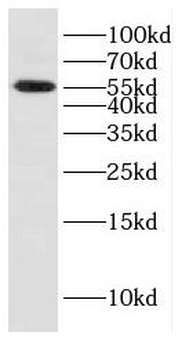 CYB5R4 Antibody