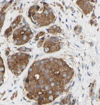 CCNB1 Rabbit Polyclonal Antibody