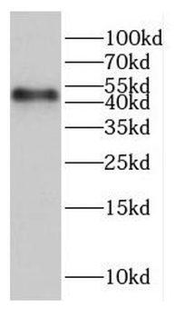UBE2D1 Antibody