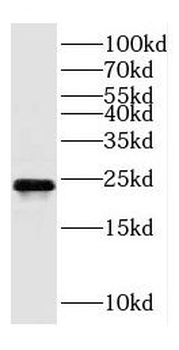 PPIB Rabbit Polyclonal Antibody