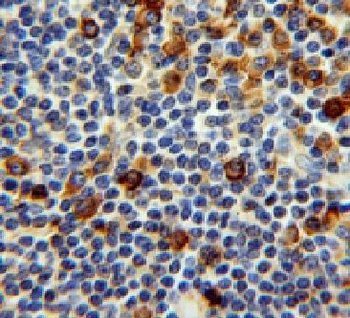 PPIB Rabbit Polyclonal Antibody
