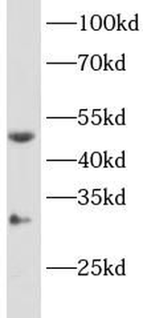 CYP11B2 Antibody