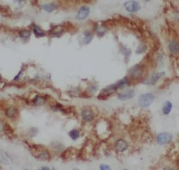 CYP11B2 Antibody