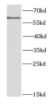 CYP1A1 Rabbit Polyclonal Antibody
