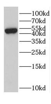 CYP1B1 Antibody