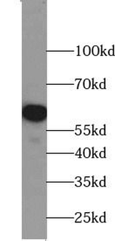 CYP24A1 Antibody