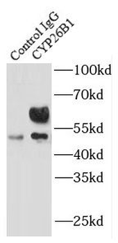 CYP26B1 Rabbit Polyclonal Antibody