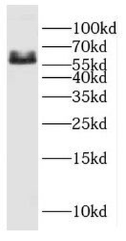 CYP26B1 Rabbit Polyclonal Antibody