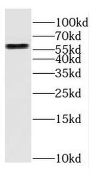 CYP27A1 Antibody