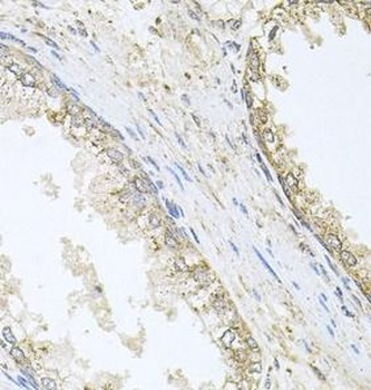 CYP46A1 Antibody
