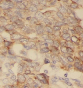 CYP4B1 Antibody