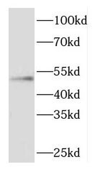 CYTH3 Rabbit Polyclonal Antibody