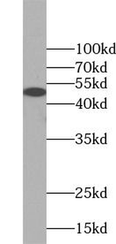 KRT15 Rabbit Polyclonal Antibody