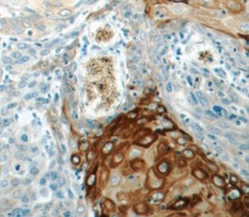 KRT15 Rabbit Polyclonal Antibody