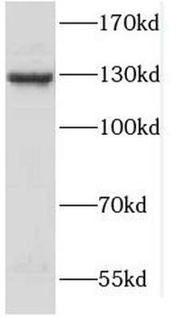 SPECC1L Rabbit Polyclonal Antibody