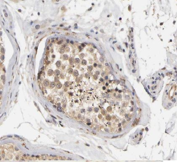 SPECC1L Rabbit Polyclonal Antibody